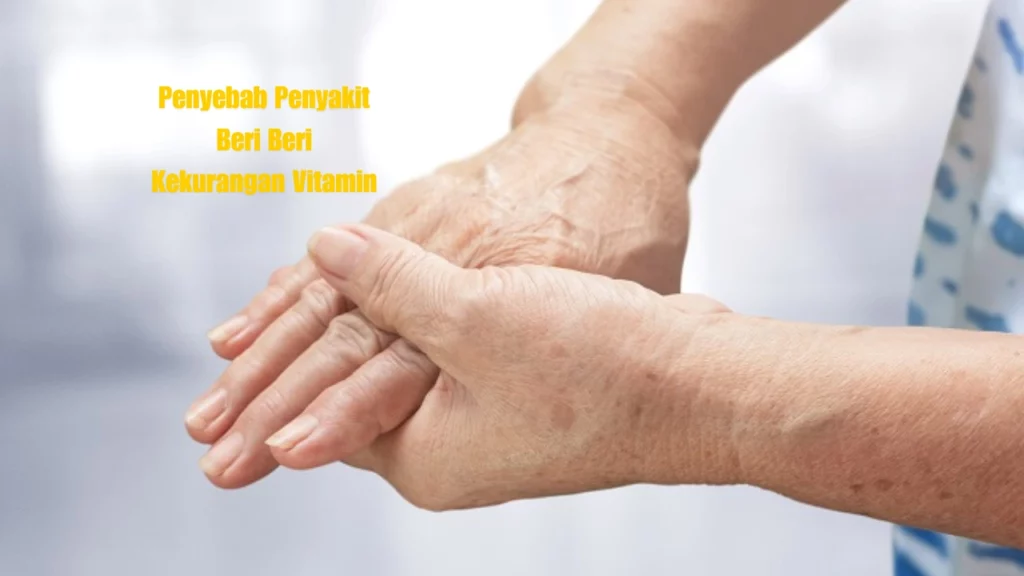 Penyebab Penyakit Beri Beri Kekurangan Vitamin