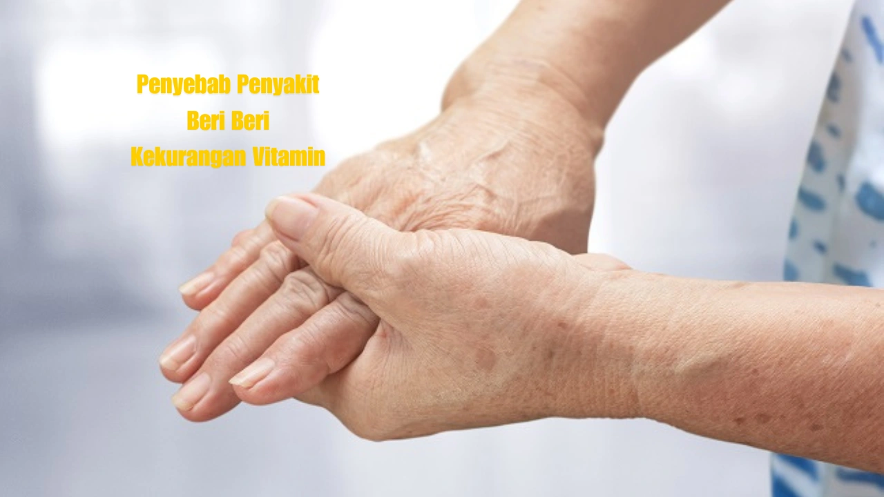 Penyakit-Beri-Beri-Kekurangan-Vitamin